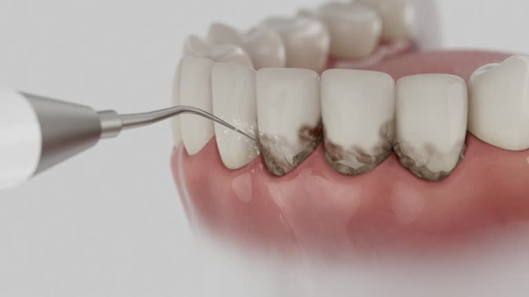 Reliable Dental Implants contractor in Douglas, GA by Smile Center Dentistry